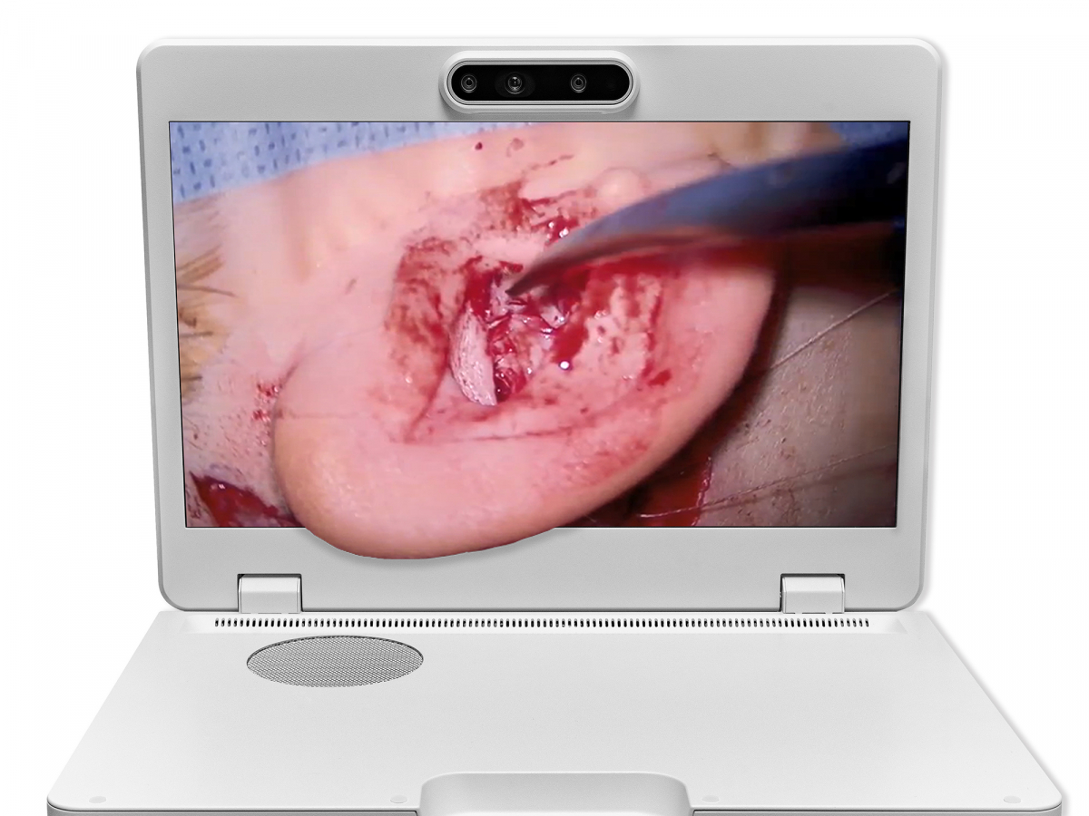 达擎之＂Heads-up 3D显微手术显示系统＂，整合4K裸眼3D显示及眼球追踪系统，具备快速追踪人眼移动位置功能，减轻医师长时间维持固定姿势的负担，让医师能有更宽广清晰的3D立体视野及更舒适的姿势来执行手术。